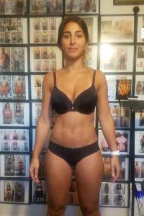 jasmine-Farahan-before